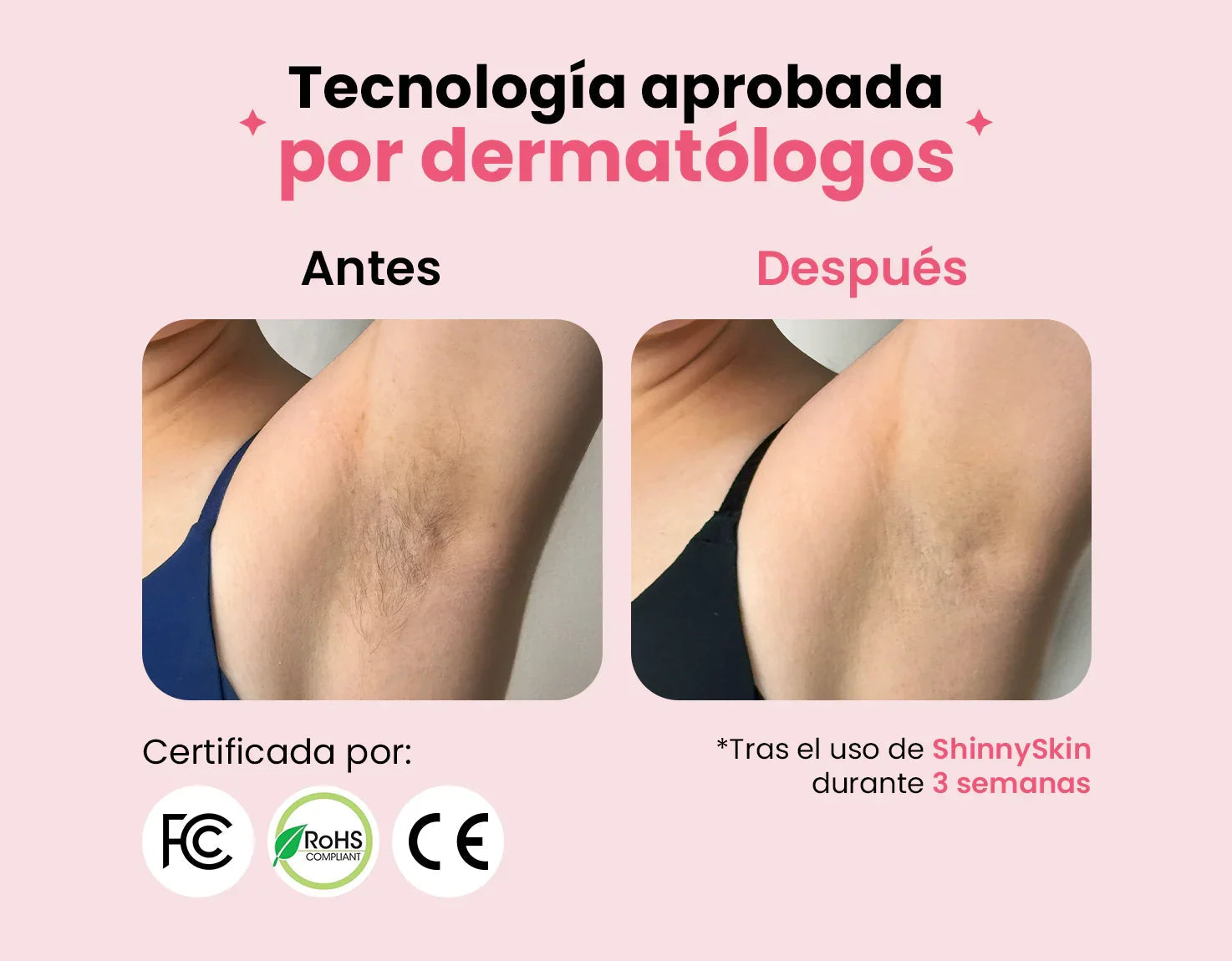 Depiladora Permanente IPL clásica